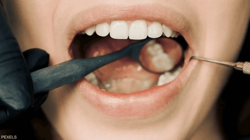 الأولى أكثر شيوعاً.. 4 أعراض تشير إلى الإصابة بسرطان الفم