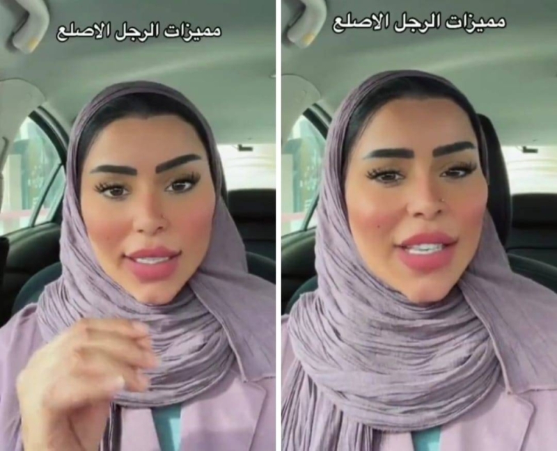 ”اعتز بصلعتك”.. مشهورة سعودية تعبر عن إعجابها بالرجل الأصلع وتكشف مميزاته 
