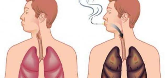 السرالجبار لتنظيف الرئة وتطهير الجسم من سموم التدخين!اكتشفه الآن واحصل على صحة رائعة