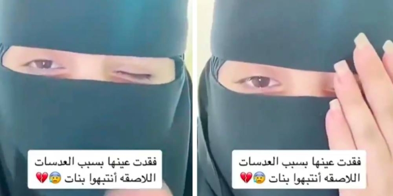 شاهد: فتاة سعودية تكشف كيف تسببت العدسات اللاصقة في فقدان إحدى عينيها
